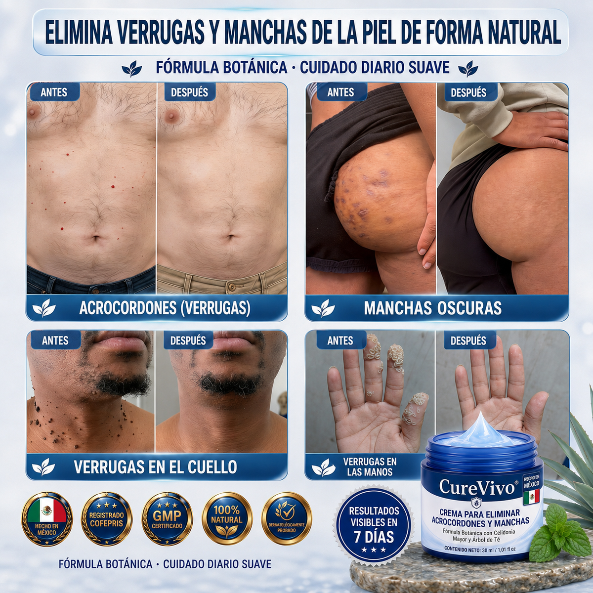 𝐂𝐮𝐫𝐞𝐕𝐢𝐯𝐨® 🛒𝐂𝐫𝐞𝐦𝐚 𝐝𝐞 𝟕 𝐝í𝐚𝐬 𝐩𝐚𝐫𝐚 𝐞𝐥𝐢𝐦𝐢𝐧𝐚𝐫 𝐚𝐜𝐫𝐨𝐜𝐨𝐫𝐝𝐨𝐧𝐞𝐬 𝐲 𝐦𝐚𝐧𝐜𝐡𝐚𝐬 (𝐟ó𝐫𝐦𝐮𝐥𝐚 𝐬𝐢𝐧 𝐝𝐨𝐥𝐨𝐫 – 𝐬𝐢𝐧 𝐜𝐢𝐜𝐚𝐭𝐫𝐢𝐜𝐞𝐬)