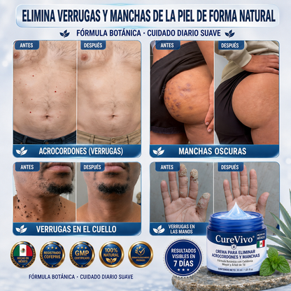 𝐂𝐮𝐫𝐞𝐕𝐢𝐯𝐨® 🛒𝐂𝐫𝐞𝐦𝐚 𝐝𝐞 𝟕 𝐝í𝐚𝐬 𝐩𝐚𝐫𝐚 𝐞𝐥𝐢𝐦𝐢𝐧𝐚𝐫 𝐚𝐜𝐫𝐨𝐜𝐨𝐫𝐝𝐨𝐧𝐞𝐬 𝐲 𝐦𝐚𝐧𝐜𝐡𝐚𝐬 (𝐟ó𝐫𝐦𝐮𝐥𝐚 𝐬𝐢𝐧 𝐝𝐨𝐥𝐨𝐫 – 𝐬𝐢𝐧 𝐜𝐢𝐜𝐚𝐭𝐫𝐢𝐜𝐞𝐬)