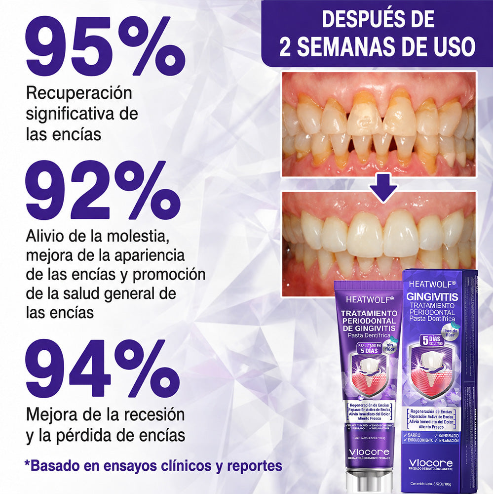 𝐏𝐚𝐬𝐭𝐚 𝐝𝐞 𝐝𝐢𝐞𝐧𝐭𝐞𝐬 𝐇𝐄𝐀𝐓𝐖𝐎𝐋® 🦷𝐕𝐢𝐨𝐂𝐨𝐫𝐞 𝐩𝐚𝐫𝐚 𝐞𝐥 𝐭𝐫𝐚𝐭𝐚𝐦𝐢𝐞𝐧𝐭𝐨 𝐝𝐞 𝐥𝐚 𝐢𝐧𝐟𝐥𝐚𝐦𝐚𝐜𝐢ó𝐧 𝐝𝐞 𝐥𝐚𝐬 𝐞𝐧𝐜í𝐚𝐬 𝐲 𝐥𝐚 𝐩𝐞𝐫𝐢𝐨𝐝𝐨𝐧𝐭𝐢𝐭𝐢𝐬