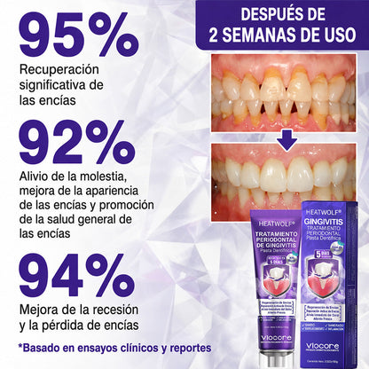 𝐏𝐚𝐬𝐭𝐚 𝐝𝐞 𝐝𝐢𝐞𝐧𝐭𝐞𝐬 𝐇𝐄𝐀𝐓𝐖𝐎𝐋® 🦷𝐕𝐢𝐨𝐂𝐨𝐫𝐞 𝐩𝐚𝐫𝐚 𝐞𝐥 𝐭𝐫𝐚𝐭𝐚𝐦𝐢𝐞𝐧𝐭𝐨 𝐝𝐞 𝐥𝐚 𝐢𝐧𝐟𝐥𝐚𝐦𝐚𝐜𝐢ó𝐧 𝐝𝐞 𝐥𝐚𝐬 𝐞𝐧𝐜í𝐚𝐬 𝐲 𝐥𝐚 𝐩𝐞𝐫𝐢𝐨𝐝𝐨𝐧𝐭𝐢𝐭𝐢𝐬