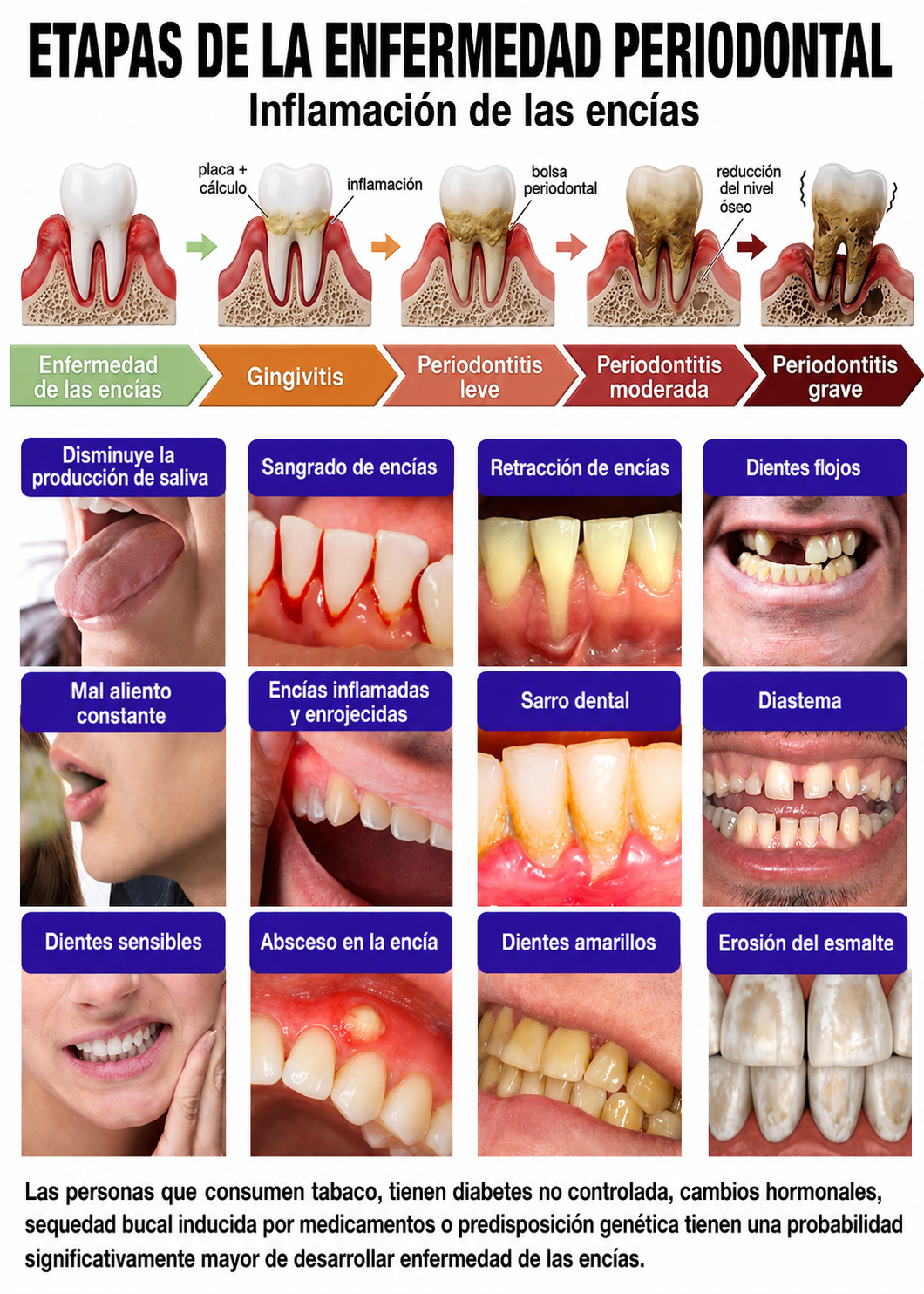𝐏𝐚𝐬𝐭𝐚 𝐝𝐞 𝐝𝐢𝐞𝐧𝐭𝐞𝐬 𝐇𝐄𝐀𝐓𝐖𝐎𝐋® 🦷𝐕𝐢𝐨𝐂𝐨𝐫𝐞 𝐩𝐚𝐫𝐚 𝐞𝐥 𝐭𝐫𝐚𝐭𝐚𝐦𝐢𝐞𝐧𝐭𝐨 𝐝𝐞 𝐥𝐚 𝐢𝐧𝐟𝐥𝐚𝐦𝐚𝐜𝐢ó𝐧 𝐝𝐞 𝐥𝐚𝐬 𝐞𝐧𝐜í𝐚𝐬 𝐲 𝐥𝐚 𝐩𝐞𝐫𝐢𝐨𝐝𝐨𝐧𝐭𝐢𝐭𝐢𝐬