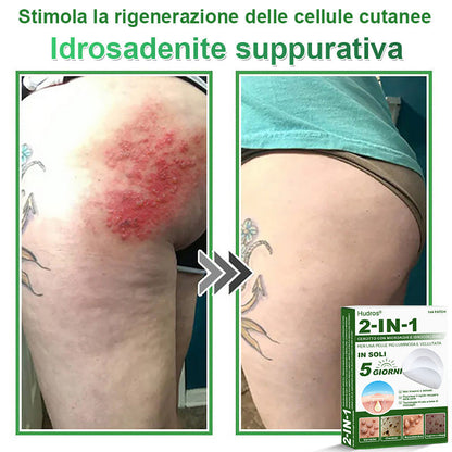 𝐇𝐮𝐝𝐫𝐨𝐬® 𝐂𝐞𝐫𝐨𝐭𝐭𝐢 𝟐 𝐢𝐧 𝟏 𝐜𝐨𝐧 𝐦𝐢𝐜𝐫𝐨𝐚𝐠𝐡𝐢 𝐞 𝐢𝐝𝐫𝐨𝐜𝐨𝐥𝐥𝐨𝐢𝐝𝐞🍀 | 𝐓𝐫𝐚𝐭𝐭𝐚𝐦𝐞𝐧𝐭𝐨 𝐦𝐢𝐫𝐚𝐭𝐨 𝐩𝐞𝐫 𝐢𝐦𝐩𝐞𝐫𝐟𝐞𝐳𝐢𝐨𝐧𝐢 𝐝𝐞𝐥𝐥𝐚 𝐩𝐞𝐥𝐥𝐞 | 𝟏𝟒𝟒 𝐩𝐞𝐳𝐳𝐢-0609-it2-1