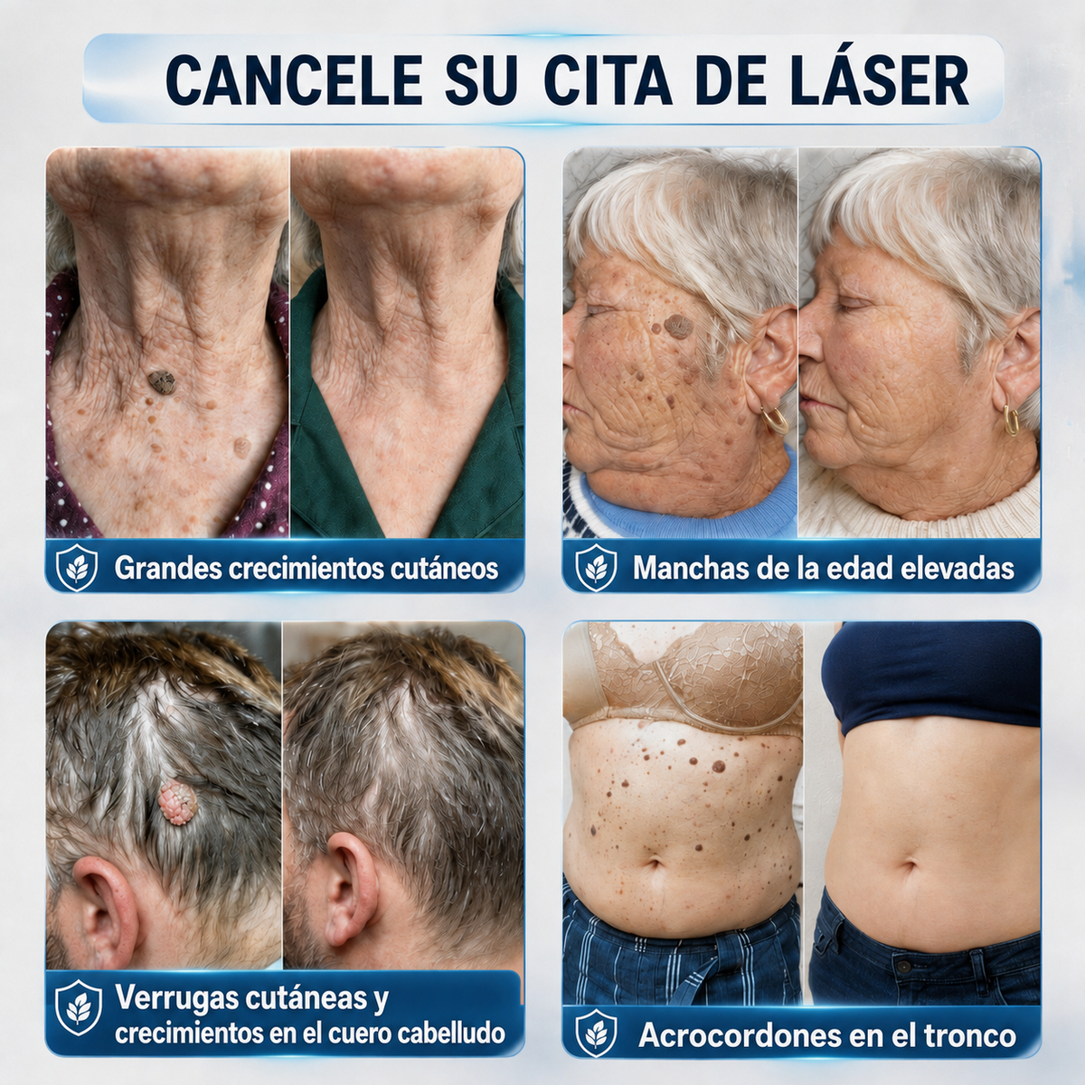 𝐂𝐮𝐫𝐞𝐕𝐢𝐯𝐨® 🛒𝐂𝐫𝐞𝐦𝐚 𝐝𝐞 𝟕 𝐝í𝐚𝐬 𝐩𝐚𝐫𝐚 𝐞𝐥𝐢𝐦𝐢𝐧𝐚𝐫 𝐚𝐜𝐫𝐨𝐜𝐨𝐫𝐝𝐨𝐧𝐞𝐬 𝐲 𝐦𝐚𝐧𝐜𝐡𝐚𝐬 (𝐟ó𝐫𝐦𝐮𝐥𝐚 𝐬𝐢𝐧 𝐝𝐨𝐥𝐨𝐫 – 𝐬𝐢𝐧 𝐜𝐢𝐜𝐚𝐭𝐫𝐢𝐜𝐞𝐬)