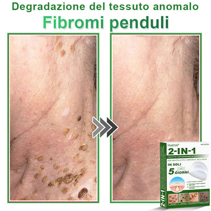 𝐇𝐮𝐝𝐫𝐨𝐬® 𝐂𝐞𝐫𝐨𝐭𝐭𝐢 𝟐 𝐢𝐧 𝟏 𝐜𝐨𝐧 𝐦𝐢𝐜𝐫𝐨𝐚𝐠𝐡𝐢 𝐞 𝐢𝐝𝐫𝐨𝐜𝐨𝐥𝐥𝐨𝐢𝐝𝐞🍀 | 𝐓𝐫𝐚𝐭𝐭𝐚𝐦𝐞𝐧𝐭𝐨 𝐦𝐢𝐫𝐚𝐭𝐨 𝐩𝐞𝐫 𝐢𝐦𝐩𝐞𝐫𝐟𝐞𝐳𝐢𝐨𝐧𝐢 𝐝𝐞𝐥𝐥𝐚 𝐩𝐞𝐥𝐥𝐞 | 𝟏𝟒𝟒 𝐩𝐞𝐳𝐳𝐢-0609-it2-1