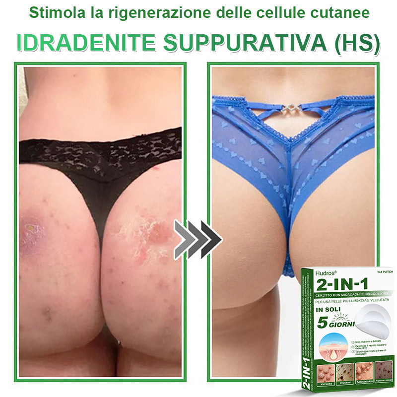 𝐇𝐮𝐝𝐫𝐨𝐬® 𝐂𝐞𝐫𝐨𝐭𝐭𝐢 𝟐 𝐢𝐧 𝟏 𝐜𝐨𝐧 𝐦𝐢𝐜𝐫𝐨𝐚𝐠𝐡𝐢 𝐞 𝐢𝐝𝐫𝐨𝐜𝐨𝐥𝐥𝐨𝐢𝐝𝐞🍀 | 𝐓𝐫𝐚𝐭𝐭𝐚𝐦𝐞𝐧𝐭𝐨 𝐦𝐢𝐫𝐚𝐭𝐨 𝐩𝐞𝐫 𝐢𝐦𝐩𝐞𝐫𝐟𝐞𝐳𝐢𝐨𝐧𝐢 𝐝𝐞𝐥𝐥𝐚 𝐩𝐞𝐥𝐥𝐞 | 𝟏𝟒𝟒 𝐩𝐞𝐳𝐳𝐢-0609-it2-1