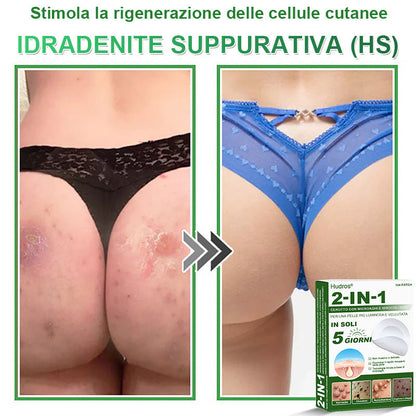 𝐇𝐮𝐝𝐫𝐨𝐬® 𝐂𝐞𝐫𝐨𝐭𝐭𝐢 𝟐 𝐢𝐧 𝟏 𝐜𝐨𝐧 𝐦𝐢𝐜𝐫𝐨𝐚𝐠𝐡𝐢 𝐞 𝐢𝐝𝐫𝐨𝐜𝐨𝐥𝐥𝐨𝐢𝐝𝐞🍀 | 𝐓𝐫𝐚𝐭𝐭𝐚𝐦𝐞𝐧𝐭𝐨 𝐦𝐢𝐫𝐚𝐭𝐨 𝐩𝐞𝐫 𝐢𝐦𝐩𝐞𝐫𝐟𝐞𝐳𝐢𝐨𝐧𝐢 𝐝𝐞𝐥𝐥𝐚 𝐩𝐞𝐥𝐥𝐞 | 𝟏𝟒𝟒 𝐩𝐞𝐳𝐳𝐢-0609-it2-1