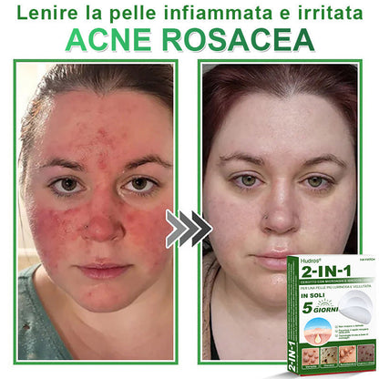 𝐇𝐮𝐝𝐫𝐨𝐬® 𝐂𝐞𝐫𝐨𝐭𝐭𝐢 𝟐 𝐢𝐧 𝟏 𝐜𝐨𝐧 𝐦𝐢𝐜𝐫𝐨𝐚𝐠𝐡𝐢 𝐞 𝐢𝐝𝐫𝐨𝐜𝐨𝐥𝐥𝐨𝐢𝐝𝐞🍀 | 𝐓𝐫𝐚𝐭𝐭𝐚𝐦𝐞𝐧𝐭𝐨 𝐦𝐢𝐫𝐚𝐭𝐨 𝐩𝐞𝐫 𝐢𝐦𝐩𝐞𝐫𝐟𝐞𝐳𝐢𝐨𝐧𝐢 𝐝𝐞𝐥𝐥𝐚 𝐩𝐞𝐥𝐥𝐞 | 𝟏𝟒𝟒 𝐩𝐞𝐳𝐳𝐢-0609-it2-1