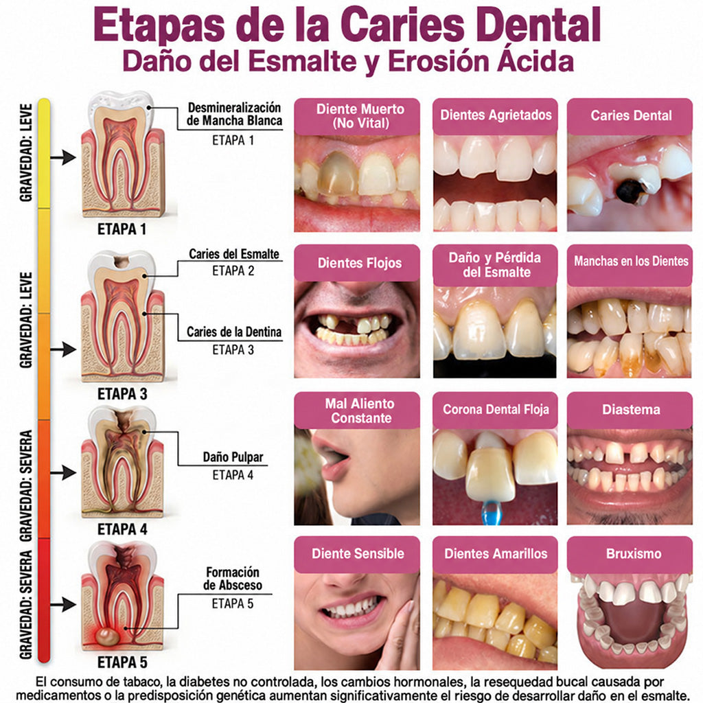 Trilumia® DenPerm🦷🥫🥫 Gel reparador de caries y relleno de esmalte natural