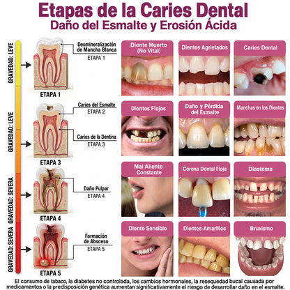 Trilumia® DenPerm🦷🥫🥫 Gel reparador de caries y relleno de esmalte natural