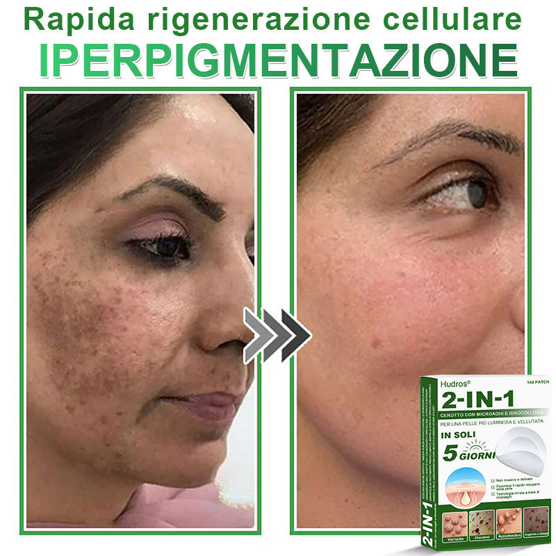 𝐇𝐮𝐝𝐫𝐨𝐬® 𝐂𝐞𝐫𝐨𝐭𝐭𝐢 𝟐 𝐢𝐧 𝟏 𝐜𝐨𝐧 𝐦𝐢𝐜𝐫𝐨𝐚𝐠𝐡𝐢 𝐞 𝐢𝐝𝐫𝐨𝐜𝐨𝐥𝐥𝐨𝐢𝐝𝐞🍀 | 𝐓𝐫𝐚𝐭𝐭𝐚𝐦𝐞𝐧𝐭𝐨 𝐦𝐢𝐫𝐚𝐭𝐨 𝐩𝐞𝐫 𝐢𝐦𝐩𝐞𝐫𝐟𝐞𝐳𝐢𝐨𝐧𝐢 𝐝𝐞𝐥𝐥𝐚 𝐩𝐞𝐥𝐥𝐞 | 𝟏𝟒𝟒 𝐩𝐞𝐳𝐳𝐢-0609-it2-1