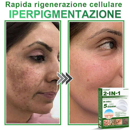 𝐇𝐮𝐝𝐫𝐨𝐬® 𝐂𝐞𝐫𝐨𝐭𝐭𝐢 𝟐 𝐢𝐧 𝟏 𝐜𝐨𝐧 𝐦𝐢𝐜𝐫𝐨𝐚𝐠𝐡𝐢 𝐞 𝐢𝐝𝐫𝐨𝐜𝐨𝐥𝐥𝐨𝐢𝐝𝐞🍀 | 𝐓𝐫𝐚𝐭𝐭𝐚𝐦𝐞𝐧𝐭𝐨 𝐦𝐢𝐫𝐚𝐭𝐨 𝐩𝐞𝐫 𝐢𝐦𝐩𝐞𝐫𝐟𝐞𝐳𝐢𝐨𝐧𝐢 𝐝𝐞𝐥𝐥𝐚 𝐩𝐞𝐥𝐥𝐞 | 𝟏𝟒𝟒 𝐩𝐞𝐳𝐳𝐢-0609-it2-1