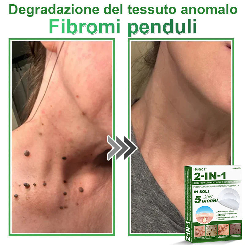 𝐇𝐮𝐝𝐫𝐨𝐬® 𝐂𝐞𝐫𝐨𝐭𝐭𝐢 𝟐 𝐢𝐧 𝟏 𝐜𝐨𝐧 𝐦𝐢𝐜𝐫𝐨𝐚𝐠𝐡𝐢 𝐞 𝐢𝐝𝐫𝐨𝐜𝐨𝐥𝐥𝐨𝐢𝐝𝐞🍀 | 𝐓𝐫𝐚𝐭𝐭𝐚𝐦𝐞𝐧𝐭𝐨 𝐦𝐢𝐫𝐚𝐭𝐨 𝐩𝐞𝐫 𝐢𝐦𝐩𝐞𝐫𝐟𝐞𝐳𝐢𝐨𝐧𝐢 𝐝𝐞𝐥𝐥𝐚 𝐩𝐞𝐥𝐥𝐞 | 𝟏𝟒𝟒 𝐩𝐞𝐳𝐳𝐢-0609-it2-1