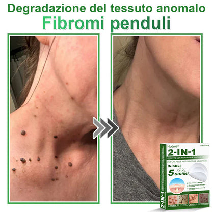 𝐇𝐮𝐝𝐫𝐨𝐬® 𝐂𝐞𝐫𝐨𝐭𝐭𝐢 𝟐 𝐢𝐧 𝟏 𝐜𝐨𝐧 𝐦𝐢𝐜𝐫𝐨𝐚𝐠𝐡𝐢 𝐞 𝐢𝐝𝐫𝐨𝐜𝐨𝐥𝐥𝐨𝐢𝐝𝐞🍀 | 𝐓𝐫𝐚𝐭𝐭𝐚𝐦𝐞𝐧𝐭𝐨 𝐦𝐢𝐫𝐚𝐭𝐨 𝐩𝐞𝐫 𝐢𝐦𝐩𝐞𝐫𝐟𝐞𝐳𝐢𝐨𝐧𝐢 𝐝𝐞𝐥𝐥𝐚 𝐩𝐞𝐥𝐥𝐞 | 𝟏𝟒𝟒 𝐩𝐞𝐳𝐳𝐢-0609-it2-1