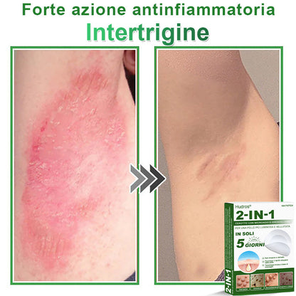 𝐇𝐮𝐝𝐫𝐨𝐬® 𝐂𝐞𝐫𝐨𝐭𝐭𝐢 𝟐 𝐢𝐧 𝟏 𝐜𝐨𝐧 𝐦𝐢𝐜𝐫𝐨𝐚𝐠𝐡𝐢 𝐞 𝐢𝐝𝐫𝐨𝐜𝐨𝐥𝐥𝐨𝐢𝐝𝐞🍀 | 𝐓𝐫𝐚𝐭𝐭𝐚𝐦𝐞𝐧𝐭𝐨 𝐦𝐢𝐫𝐚𝐭𝐨 𝐩𝐞𝐫 𝐢𝐦𝐩𝐞𝐫𝐟𝐞𝐳𝐢𝐨𝐧𝐢 𝐝𝐞𝐥𝐥𝐚 𝐩𝐞𝐥𝐥𝐞 | 𝟏𝟒𝟒 𝐩𝐞𝐳𝐳𝐢-0609-it2-1