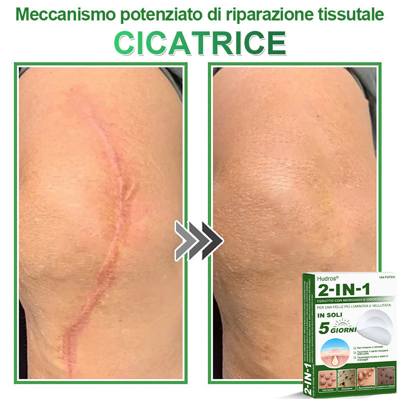𝐇𝐮𝐝𝐫𝐨𝐬® 𝐂𝐞𝐫𝐨𝐭𝐭𝐢 𝟐 𝐢𝐧 𝟏 𝐜𝐨𝐧 𝐦𝐢𝐜𝐫𝐨𝐚𝐠𝐡𝐢 𝐞 𝐢𝐝𝐫𝐨𝐜𝐨𝐥𝐥𝐨𝐢𝐝𝐞🍀 | 𝐓𝐫𝐚𝐭𝐭𝐚𝐦𝐞𝐧𝐭𝐨 𝐦𝐢𝐫𝐚𝐭𝐨 𝐩𝐞𝐫 𝐢𝐦𝐩𝐞𝐫𝐟𝐞𝐳𝐢𝐨𝐧𝐢 𝐝𝐞𝐥𝐥𝐚 𝐩𝐞𝐥𝐥𝐞 | 𝟏𝟒𝟒 𝐩𝐞𝐳𝐳𝐢-0609-it2-1