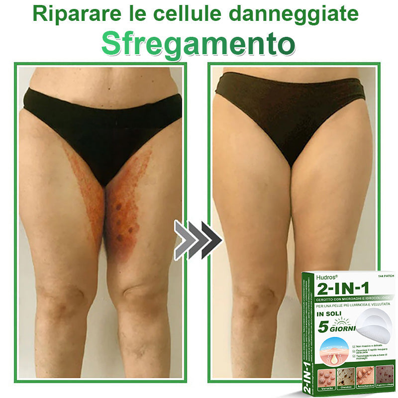 𝐇𝐮𝐝𝐫𝐨𝐬® 𝐂𝐞𝐫𝐨𝐭𝐭𝐢 𝟐 𝐢𝐧 𝟏 𝐜𝐨𝐧 𝐦𝐢𝐜𝐫𝐨𝐚𝐠𝐡𝐢 𝐞 𝐢𝐝𝐫𝐨𝐜𝐨𝐥𝐥𝐨𝐢𝐝𝐞🍀 | 𝐓𝐫𝐚𝐭𝐭𝐚𝐦𝐞𝐧𝐭𝐨 𝐦𝐢𝐫𝐚𝐭𝐨 𝐩𝐞𝐫 𝐢𝐦𝐩𝐞𝐫𝐟𝐞𝐳𝐢𝐨𝐧𝐢 𝐝𝐞𝐥𝐥𝐚 𝐩𝐞𝐥𝐥𝐞 | 𝟏𝟒𝟒 𝐩𝐞𝐳𝐳𝐢-0609-it2-1