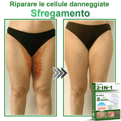 𝐇𝐮𝐝𝐫𝐨𝐬® 𝐂𝐞𝐫𝐨𝐭𝐭𝐢 𝟐 𝐢𝐧 𝟏 𝐜𝐨𝐧 𝐦𝐢𝐜𝐫𝐨𝐚𝐠𝐡𝐢 𝐞 𝐢𝐝𝐫𝐨𝐜𝐨𝐥𝐥𝐨𝐢𝐝𝐞🍀 | 𝐓𝐫𝐚𝐭𝐭𝐚𝐦𝐞𝐧𝐭𝐨 𝐦𝐢𝐫𝐚𝐭𝐨 𝐩𝐞𝐫 𝐢𝐦𝐩𝐞𝐫𝐟𝐞𝐳𝐢𝐨𝐧𝐢 𝐝𝐞𝐥𝐥𝐚 𝐩𝐞𝐥𝐥𝐞 | 𝟏𝟒𝟒 𝐩𝐞𝐳𝐳𝐢-0609-it2-1